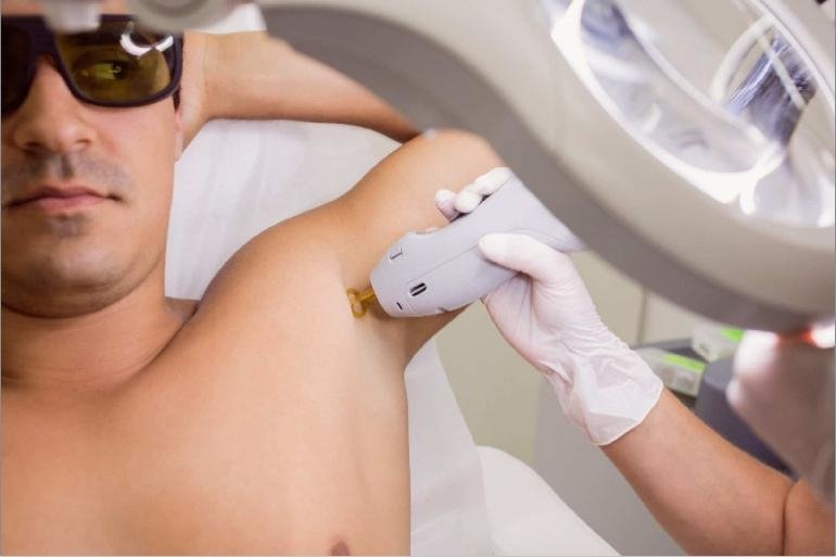 Why Do Men Prefer Laser Body Hair Removal Treatment?